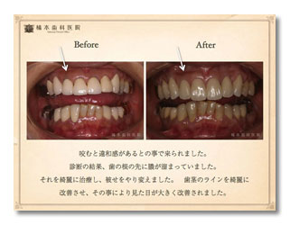 一般・歯周病・審美1