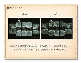 一般・歯周病・審美2