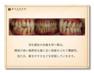 歯周病・審美・咬合補綴1-3